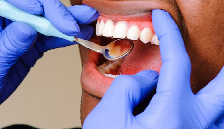 Dental or Implant. What is the Best?